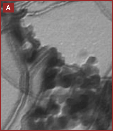 Animation flicking between the two duplicated regions of the micrograph — the particles stay fixed, showing they are the same field