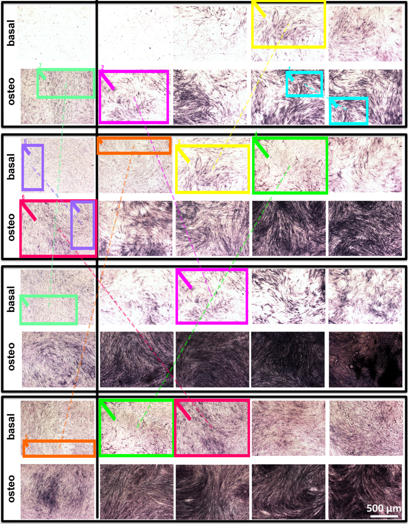 Copy-move duplication overlay — matched regions across basal and osteo micrograph panels